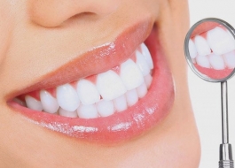 Thay đổi diện mạo với dịch vụ bọc răng sứ thẩm mỹ
