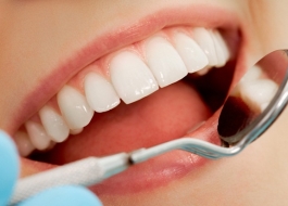 Răng sứ Ceramill Zolid loại răng cao cấp đảm bảo tính thẩm mỹ